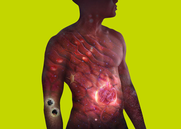 Image of male body representative of AstraZeneca’s Cardiovascular, Renal and Metabolism therapy area.